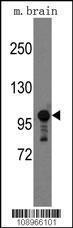 Anti-Semaphorin 5A Rabbit Polyclonal Antibody (APC (Allophycocyanin))