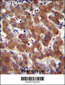 Anti-AR Rabbit Polyclonal Antibody