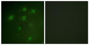 Immunofluorescence analysis of HeLa cells using Anti-PDCD4 Antibody. The right hand panel represents a negative control, where the antibody was pre-incubated with the immunising peptide.