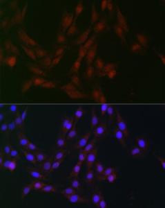 Immunofluorescence analysis of C6 cells using Anti-CDK1 Antibody (A305460) at a dilution of 1:100 (40X lens). DAPI was used to stain the cell nuclei (blue)