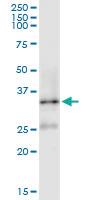 Anti-DNAJB1 Rabbit Polyclonal Antibody