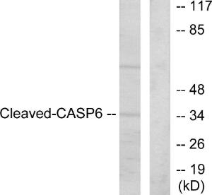 Anti-Caspase 6