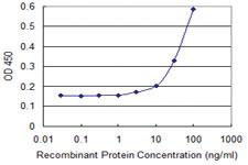 Anti-RHOC Mouse Monoclonal Antibody [clone: 1B7]