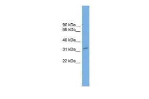 Anti-MMADHC Rabbit Polyclonal Antibody