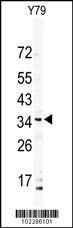 Anti-DSCR3 Rabbit Polyclonal Antibody (AP (Alkaline Phosphatase))