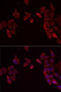 Immunofluorescence analysis of MCF7 cells using Anti-RAMP3 Antibody (A9978). DAPI was used to stain the cell nuclei (blue)