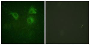 Immunofluorescence analysis of HUVEC cells using Anti-CDC25B Antibody. The right hand panel represents a negative control, where the antibody was pre-incubated with the immunising peptide