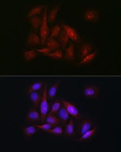 Immunofluorescence analysis of U-2 OS cells using Anti-CDK1 Antibody (A305460) at a dilution of 1:100 (40X lens). DAPI was used to stain the cell nuclei (blue)