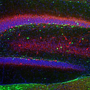 Immunofluorescent analysis of a section of rat hippocampus section stained with Anti-Calretinin Antibody (1:2,000/green) and co-stained with Anti-Parvalbumin Antibody (A85316/1:1,000/red)