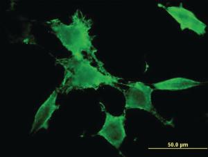 Anti-PAK3 Mouse Monoclonal Antibody [clone: 3A12]