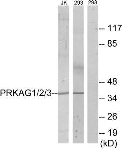 Western blot analysis of lysates from 293 and Jurkat cells using Anti-PRKAG1 + PRKAG2 + PRKAG3 Antibody. The right hand lane represents a negative control, where the Antibody is blocked by the immunising peptide