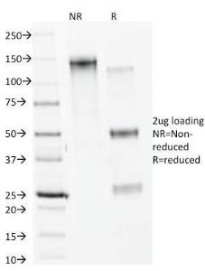 SDS-PAGE analysis of Anti-Calnexin Antibody [CANX/1541] under non-reduced and reduced conditions; showing intact IgG and intact heavy and light chains, respectively. SDS-PAGE analysis confirms the integrity and purity of the antibody