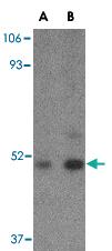 Anti-TBC1D10C Rabbit Polyclonal Antibody