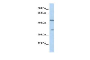 Anti-OR2L8 Rabbit Polyclonal Antibody