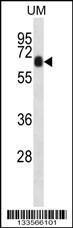 Anti-CCDC120 Rabbit Polyclonal Antibody (FITC (Fluorescein Isothiocyanate))