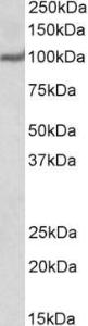 Approx 100kDa band observed in Human Heart lysates (calculated MW of 104kDa according to NP_955475.1). Recommended concentration: 1-3 µg/ml