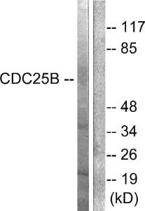 Western blot analysis of lysates from Raw264.7 cells, treated with Hu 2nM 24h using Anti-CDC25B Antibody. The right hand lane represents a negative control, where the antibody is blocked by the immunising peptide