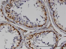 Anti-RND3 Mouse Monoclonal Antibody [clone: 1D2]