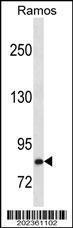 Anti-HGF Mouse Monoclonal Antibody [clone: 489CT6.12.6]