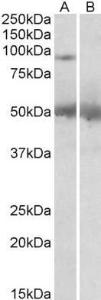 Anti-USP6 Antibody (A83933) (2 µg/ml) staining of Human Placenta lysate (35 µg protein in RIPA buffer) with (B) and without (A) blocking with the immunizing peptide. Primary incubation was 1 hour. Detected by chemiluminescence