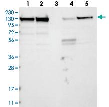 Anti-MATR3 Rabbit Polyclonal Antibody