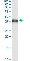 Anti-STOML2 Rabbit Polyclonal Antibody