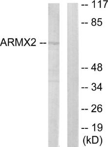 Western blot analysis of lysates from 293 cells using Anti-ARMCX2 Antibody. The right hand lane represents a negative control, where the antibody is blocked by the immunising peptide