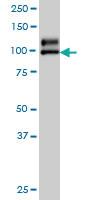 Anti-NDST1 Mouse Monoclonal Antibody [clone: 1G10]