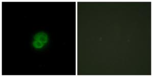 Immunofluorescence analysis of HepG2 cells using Anti-ARMCX2 Antibody. The right hand panel represents a negative control, where the antibody was pre-incubated with the immunising peptide