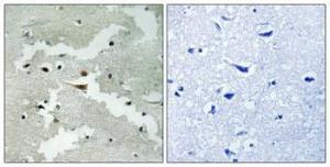 Immunohistochemical analysis of paraffin-embedded human brain using Anti-PDCD4 Antibody 1:100 (4°C overnight). The right hand panel represents a negative control, where the antibody was pre-incubated with the immunising peptide.