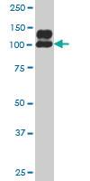 Anti-NDST1 Mouse Monoclonal Antibody [clone: 2F11]