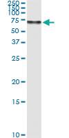 Anti-SERPINF2 Polyclonal Antibody Pair