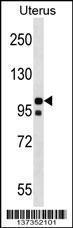 Anti-NLRP4 Rabbit Polyclonal Antibody (PE (Phycoerythrin))