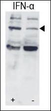 Anti-STAT3 Rabbit Polyclonal Antibody (FITC (Fluorescein))