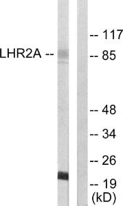 Western blot analysis of lysates from 293 cells using Anti-LHR2A Antibody. The right hand lane represents a negative control, where the antibody is blocked by the immunising peptide