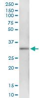 Anti-HSD17B7 Polyclonal Antibody Pair