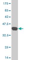 Anti-RCVRN Mouse Monoclonal Antibody [clone: 2B3]