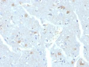 Antibody anti-UBE2C CPTC-UBE2C-1 100 µg