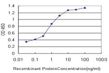 Anti-PALM Mouse Monoclonal Antibody [clone: 7C5]