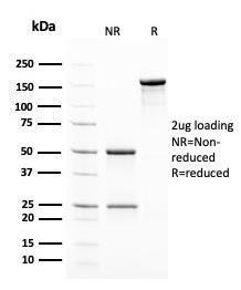 SDS-PAGE analysis of Anti-Insulin Antibody [2D11-H5] under non-reduced and reduced conditions; showing intact IgG and intact heavy and light chains, respectively. SDS-PAGE analysis confirms the integrity and purity of the Antibody