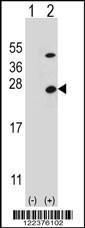 Anti-ATP5O Rabbit Polyclonal Antibody (FITC (Fluorescein))