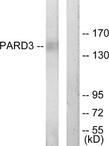 Western blot analysis of lysates from COLO205 cells using Anti-PARD3 Antibody. The right hand lane represents a negative control, where the antibody is blocked by the immunising peptide.