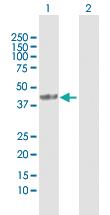 Anti-STOML2 Rabbit Polyclonal Antibody