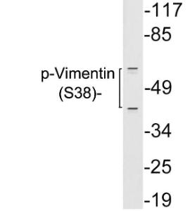 Western blot analysis of lysates from 293 cells treated with paclitaxel using Anti-Vimentin (phospho Ser38) Antibody