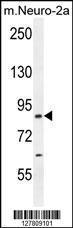 Anti-CEP89 Rabbit Polyclonal Antibody (AP (Alkaline Phosphatase))