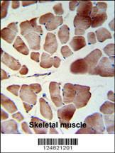 Anti-PATL1 Rabbit Polyclonal Antibody (FITC (Fluorescein Isothiocyanate))