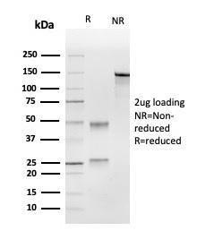 Antibody anti-UBE2C CPTC-UBE2C-1 100 µg