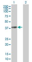 Anti-PARK2 Mouse Polyclonal Antibody