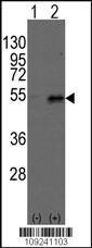 Anti-DTNBP1 Rabbit Polyclonal Antibody (Biotin)