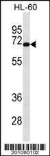 Anti-HIPK4 Mouse Monoclonal Antibody [clone: 292CT1.4.1]